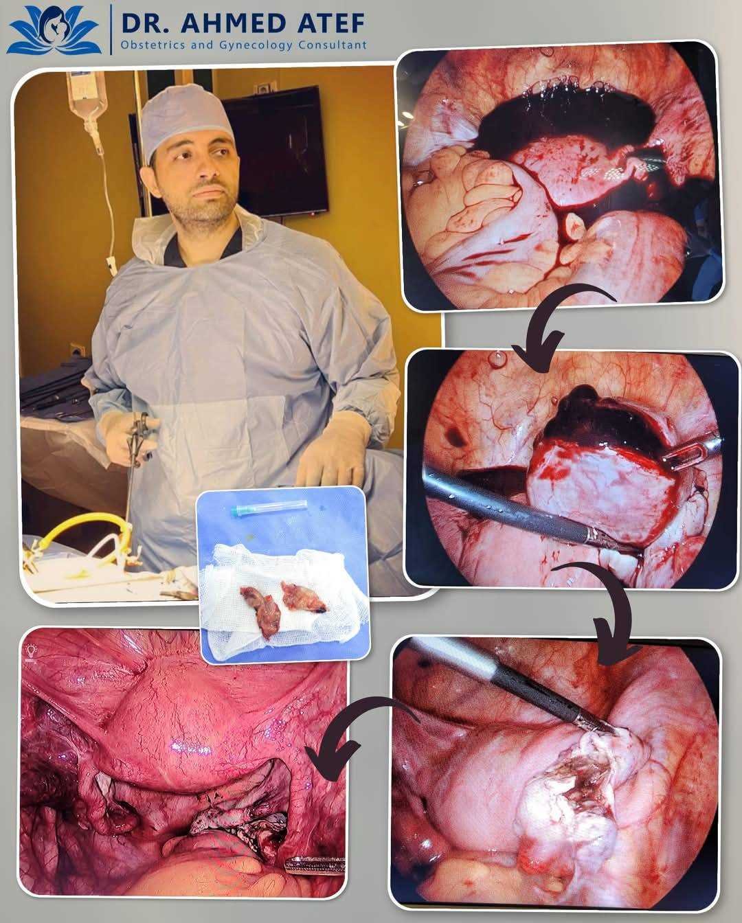 doctor-ahmed-atef-gynaecology-and-infertility_20241217174419353