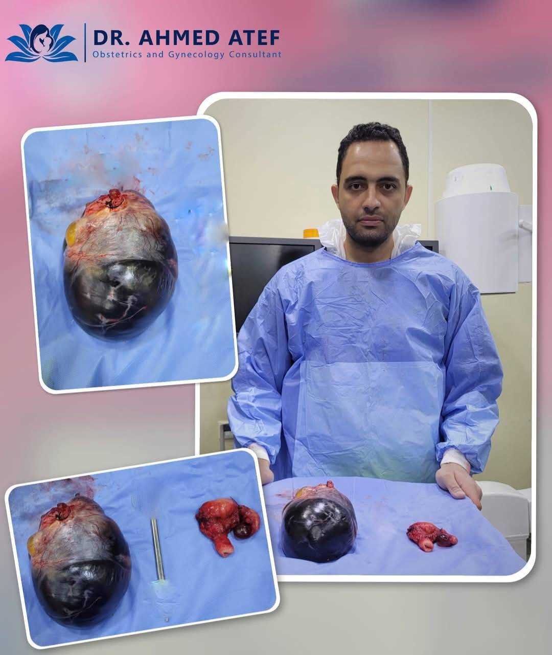 doctor-ahmed-atef-gynaecology-and-infertility_20241217174600761