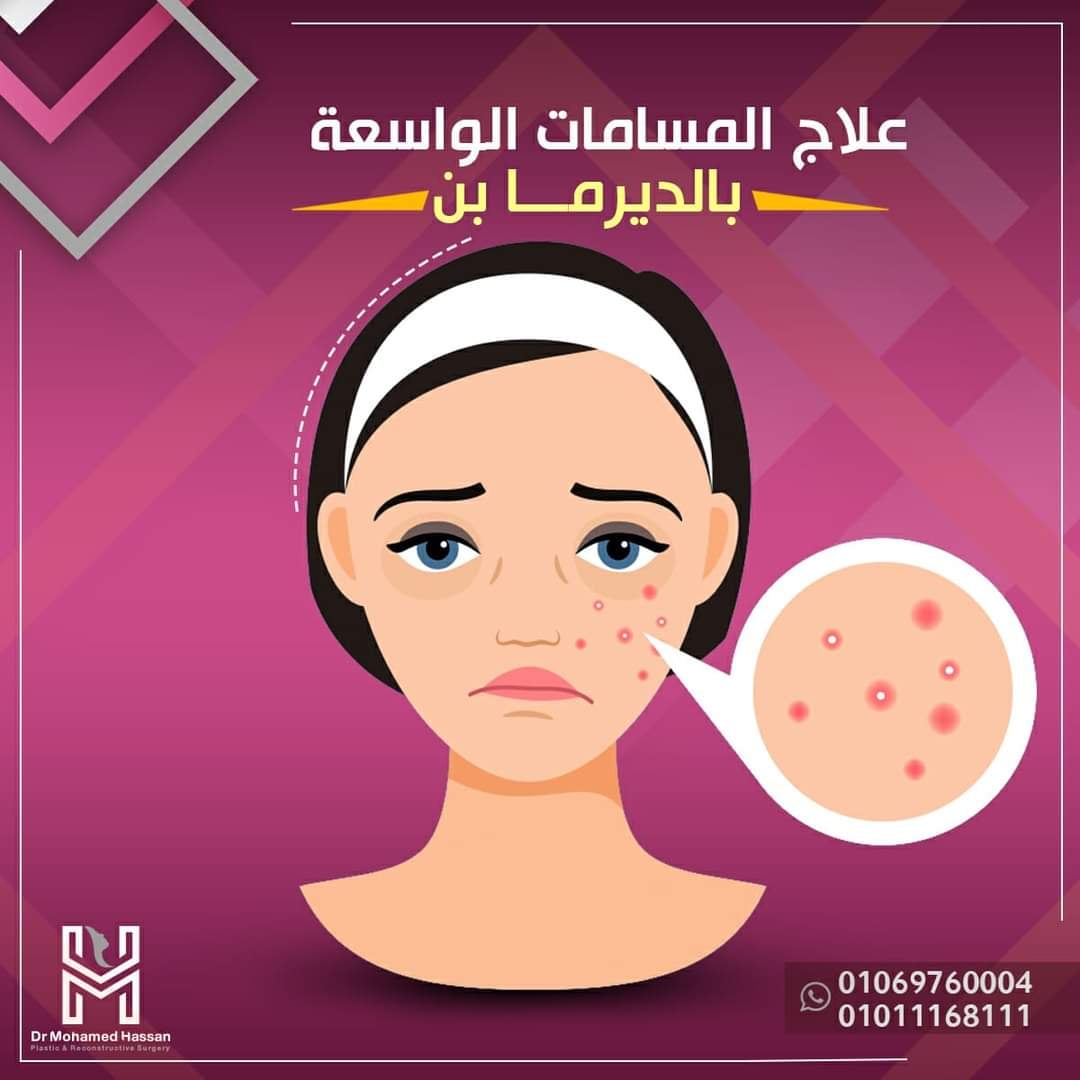 469022700_584230040680086_4055584474896089658_n