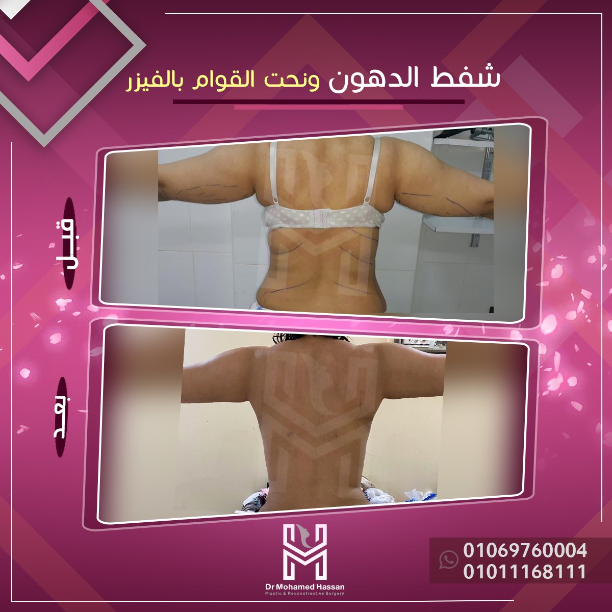 469040691_584245480678542_4745343189535601389_n