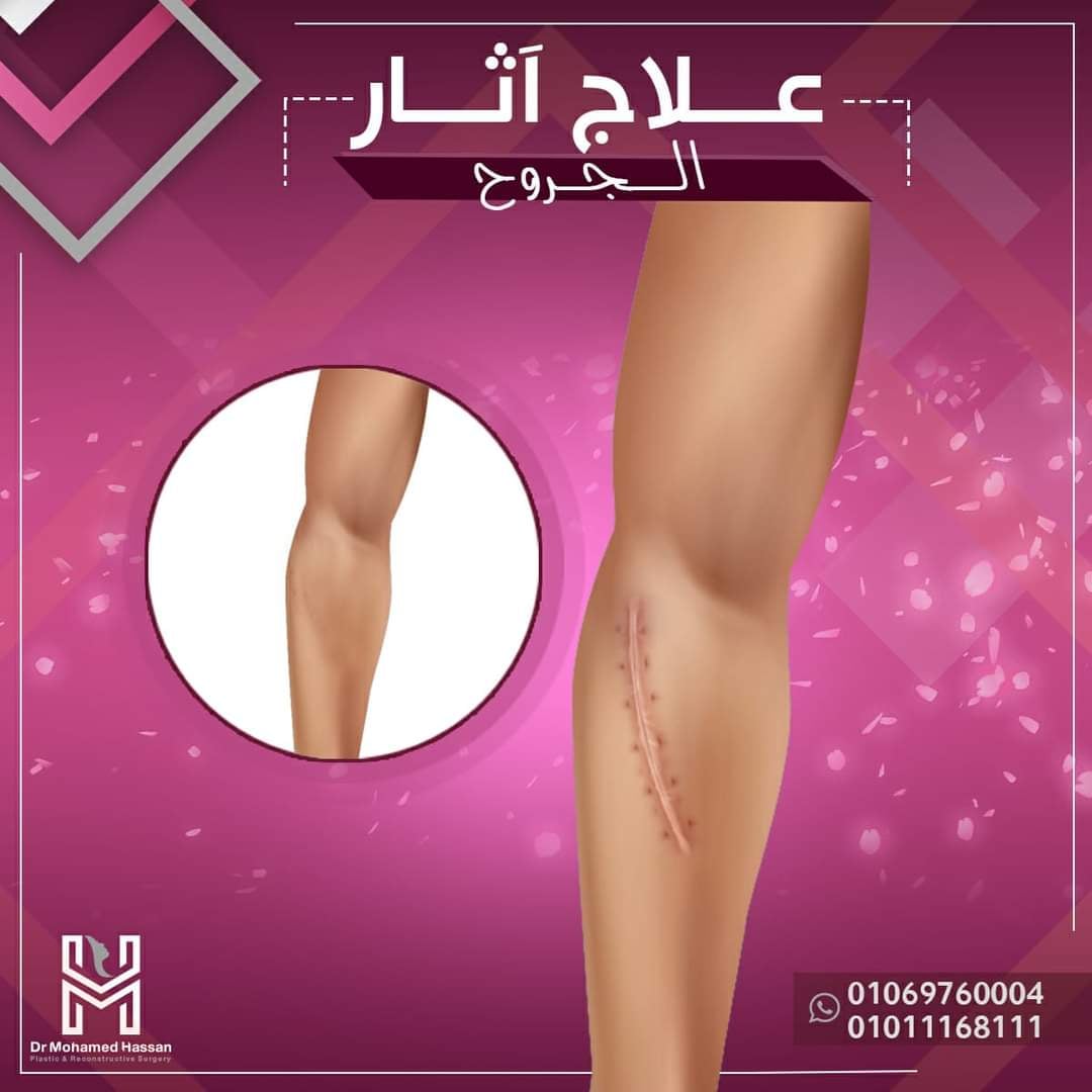 469041791_584230157346741_7685425618242424180_n