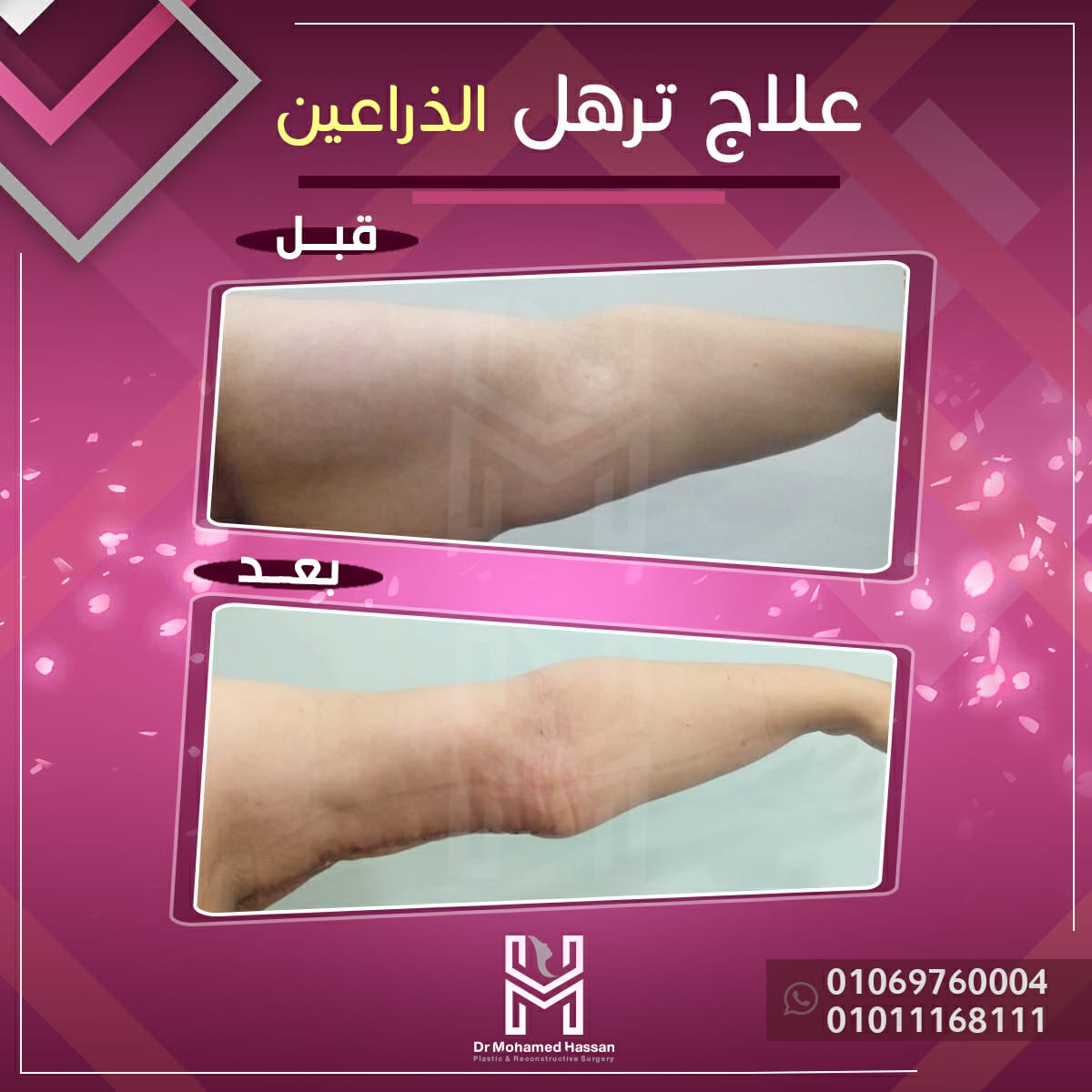 469670435_588354800267610_8265721101538661027_n