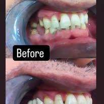 470883936_122184229322143285_1752490789840900338_n