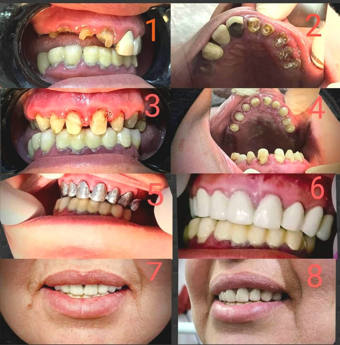 474069170_122201495954230929_7869111322631184392_n