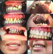 474069170_122201495954230929_7869111322631184392_n