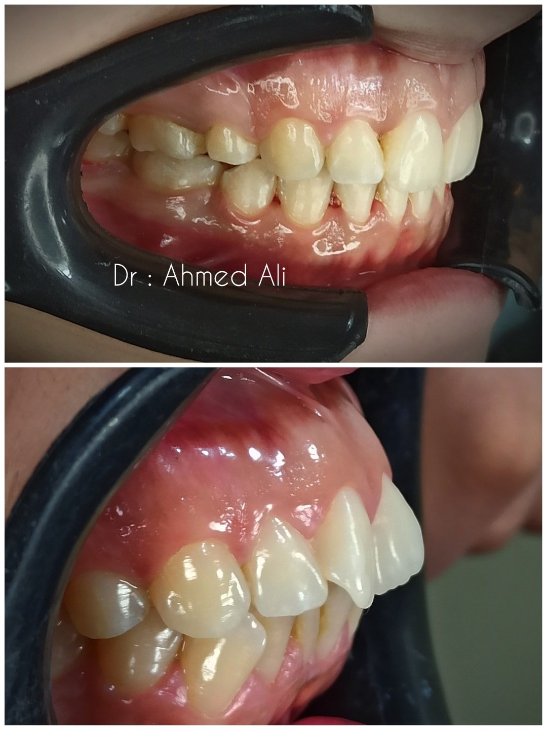 557476468_1337840005018735_6211983443631760217_n