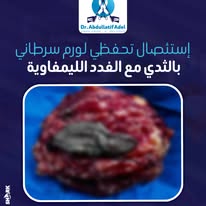 560246889_122135037578415578_1817330276028372395_n