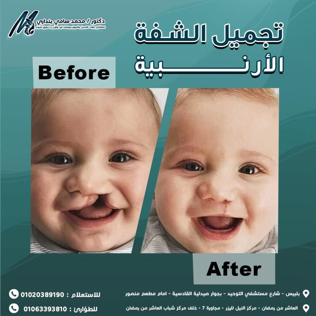 472818419_122132238572548853_1082950376959847582_n