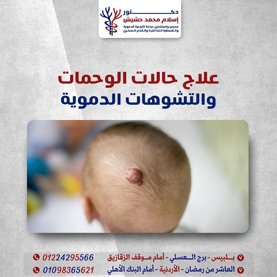 494700105_122111505044840354_4536499787884413541_n