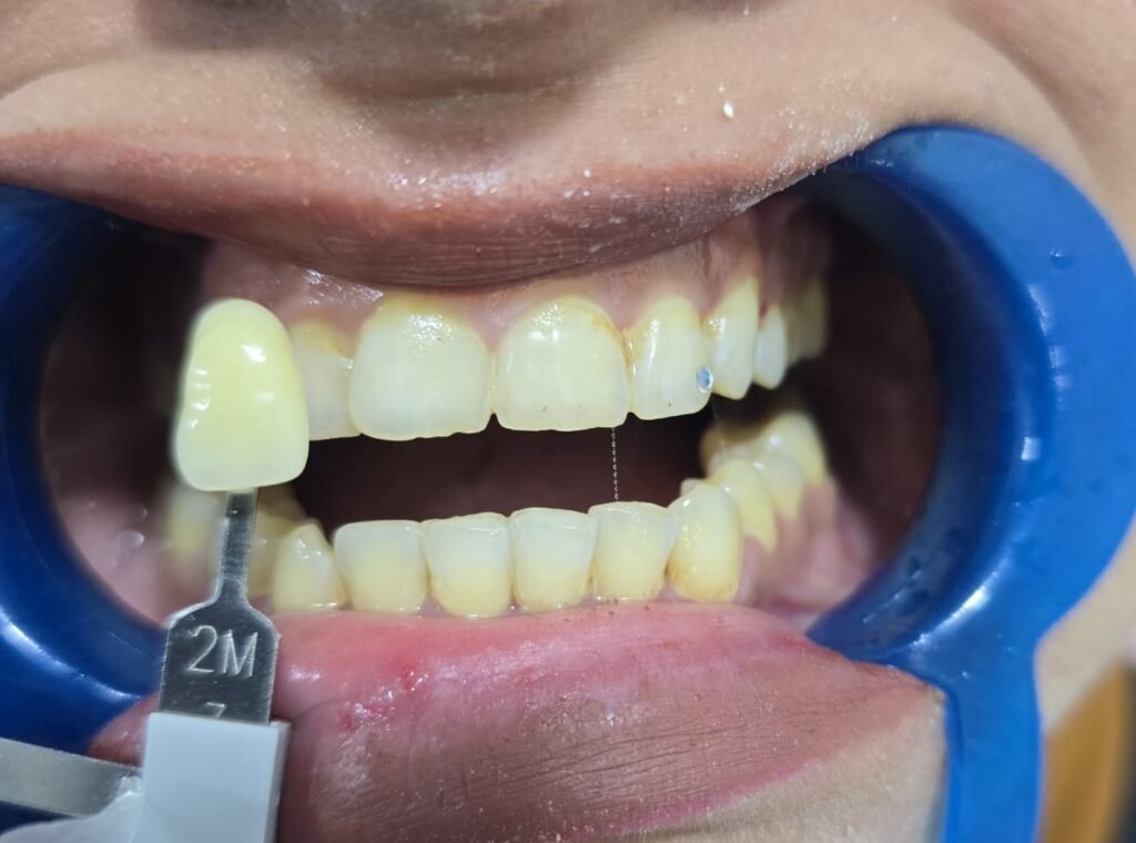 WhatsApp Image 2026-01-12 at 16.22.37